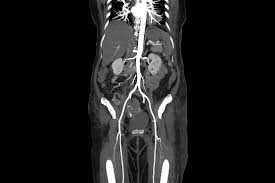 Vascular Imaging